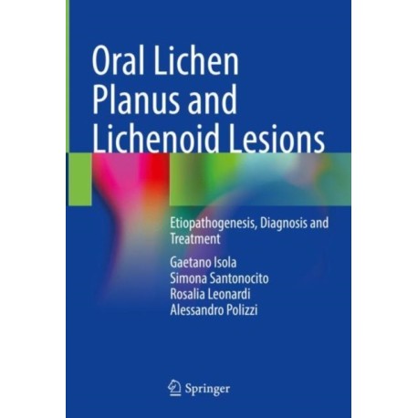 Oral Lichen Planus and Lichenoid Lesions: Etiopathogenesis, Diagnosis and Treatment