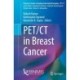 PET/CT in Breast Cancer