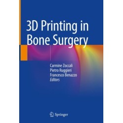 3D Printing in Bone Surgery