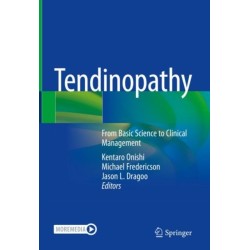 Tendinopathy: From Basic Science to Clinical Management