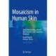 Mosaicism in Human Skin: Understanding Nevi, Nevoid Skin Disorders, and Cutaneous Neoplasia