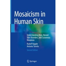 Mosaicism in Human Skin: Understanding Nevi, Nevoid Skin Disorders, and Cutaneous Neoplasia