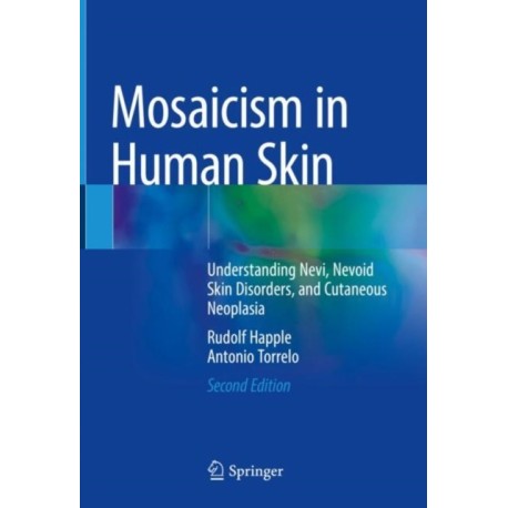 Mosaicism in Human Skin: Understanding Nevi, Nevoid Skin Disorders, and Cutaneous Neoplasia