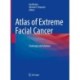 Atlas of Extreme Facial  Cancer: Challenges and Solutions
