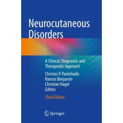 Neurocutaneous Disorders: A Clinical, Diagnostic and Therapeutic Approach