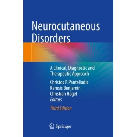 Neurocutaneous Disorders: A Clinical, Diagnostic and Therapeutic Approach