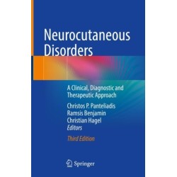 Neurocutaneous Disorders: A Clinical, Diagnostic and Therapeutic Approach