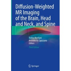 Diffusion-Weighted MR Imaging of the Brain, Head and Neck, and Spine