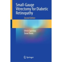 Small-Gauge Vitrectomy for Diabetic Retinopathy