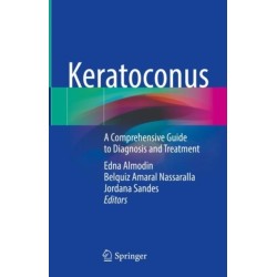 Keratoconus: A Comprehensive Guide to Diagnosis and Treatment