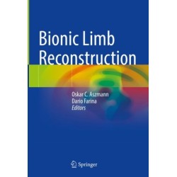 Bionic Limb Reconstruction