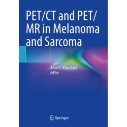 PET/CT and PET/MR in Melanoma and Sarcoma