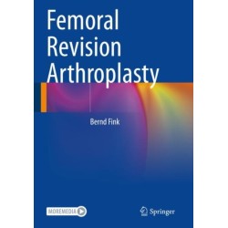 Femoral Revision Arthroplasty