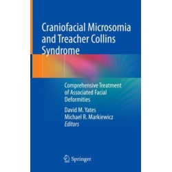 Craniofacial Microsomia and Treacher Collins Syndrome: Comprehensive Treatment of Associated Facial Deformities
