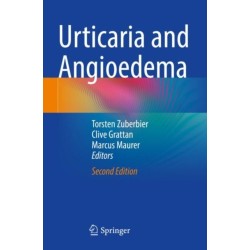 Urticaria and Angioedema