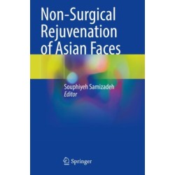 Non-Surgical Rejuvenation of Asian Faces