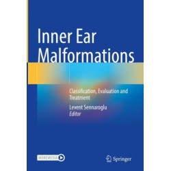 Inner Ear Malformations: Classification, Evaluation and Treatment