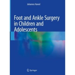 Foot and Ankle Surgery in Children and Adolescents