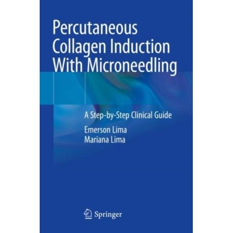 Percutaneous Collagen Induction With Microneedling: A Step-by-Step Clinical Guide