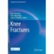 Knee Fractures