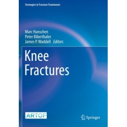 Knee Fractures