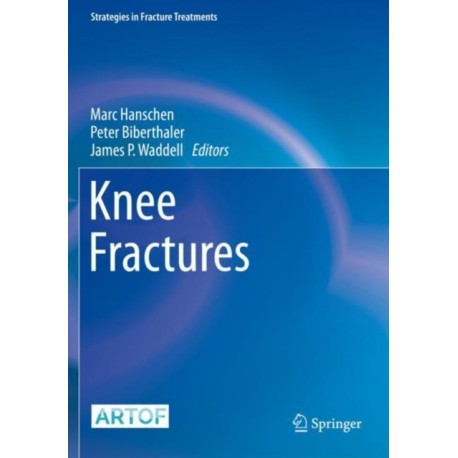 Knee Fractures