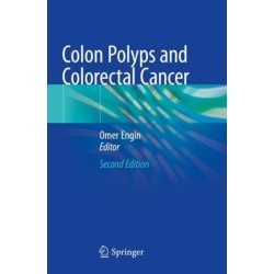 Colon Polyps and Colorectal Cancer
