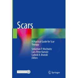 Scars: A Practical Guide for Scar Therapy