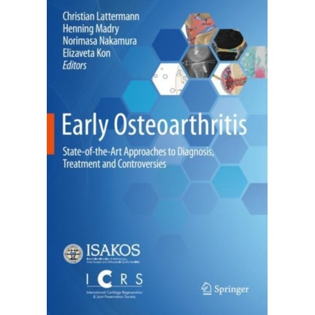 Early Osteoarthritis: State-of-the-Art Approaches to Diagnosis, Treatment and Controversies