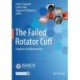 The Failed Rotator Cuff: Diagnosis and Management