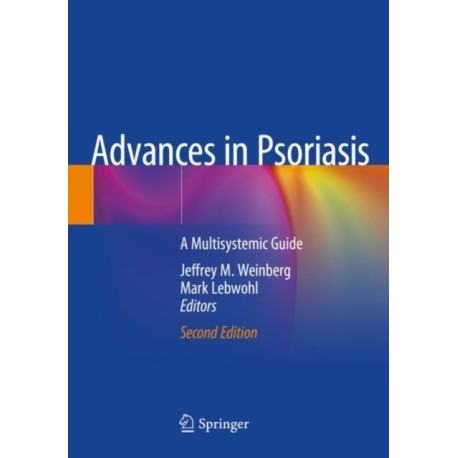 Advances in Psoriasis: A Multisystemic Guide