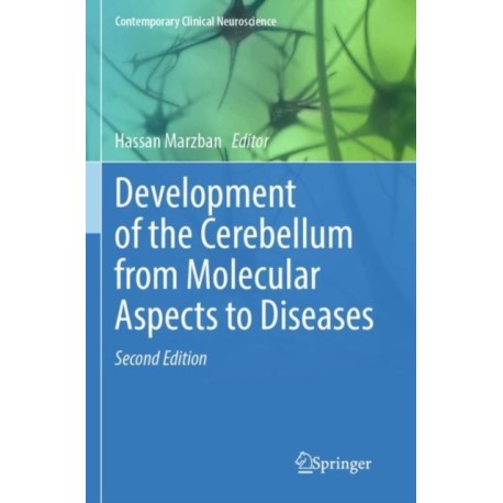 Development of the Cerebellum from Molecular Aspects to Diseases