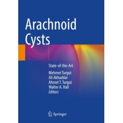 Arachnoid Cysts: State-of-the-Art