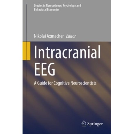 Intracranial EEG: A Guide for Cognitive Neuroscientists