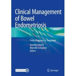 Clinical Management of Bowel Endometriosis: From Diagnosis to Treatment