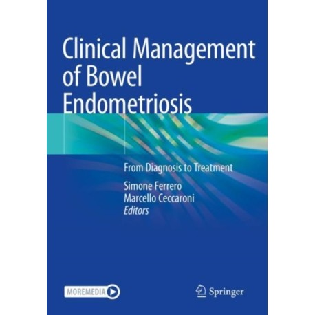 Clinical Management of Bowel Endometriosis: From Diagnosis to Treatment