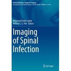 Imaging of Spinal Infection