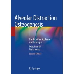 Alveolar Distraction Osteogenesis: The ArchWise Appliance and Technique