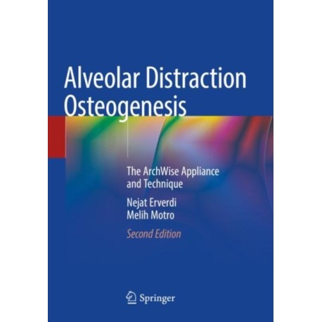 Alveolar Distraction Osteogenesis: The ArchWise Appliance and Technique