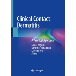 Clinical Contact Dermatitis: A Practical Approach