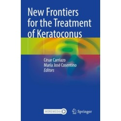 New Frontiers for the Treatment of Keratoconus