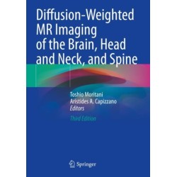 Diffusion-Weighted MR Imaging of the Brain, Head and Neck, and Spine