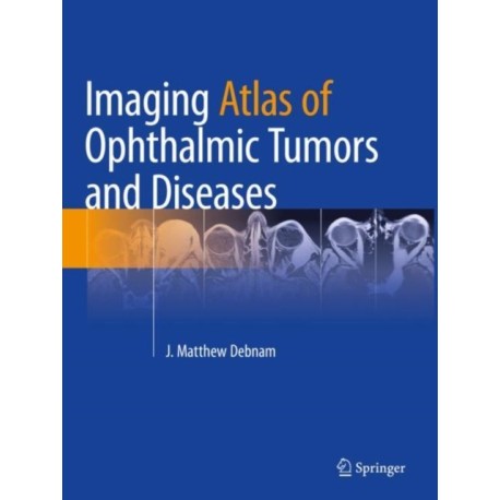 Imaging Atlas of Ophthalmic Tumors and Diseases