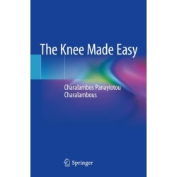 The Knee Made Easy