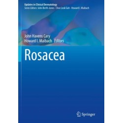 Rosacea