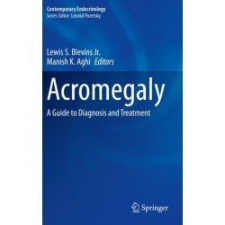 Acromegaly: A Guide to Diagnosis and Treatment