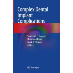 Complex Dental Implant Complications
