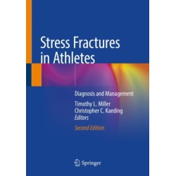 Stress Fractures in Athletes: Diagnosis and Management