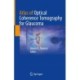 Atlas of Optical Coherence Tomography for Glaucoma