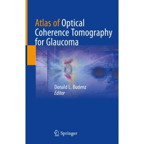 Atlas of Optical Coherence Tomography for Glaucoma